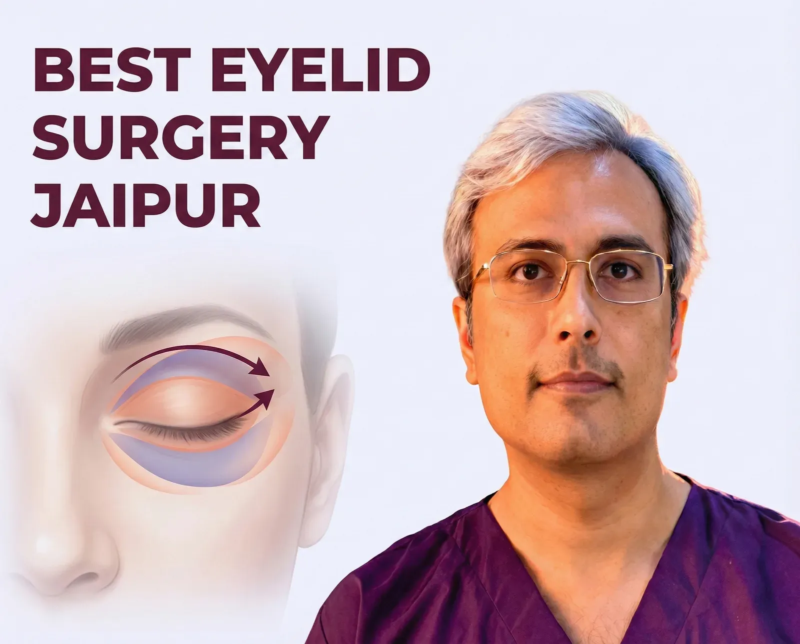 Best Cosmetic Blepharoplasty in Jaipur - Dr. Vishal Purohit Plastic Surgeon Jaipur