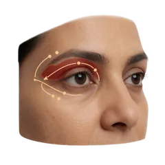 Impaired Peripheral Vision