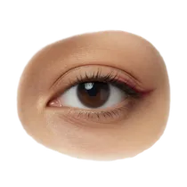 Medial Upper Fat Pad