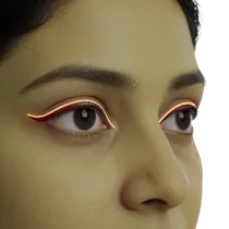 Supratarsal Crease
