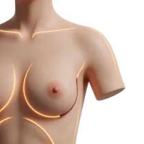 Nipple-Areola Centering