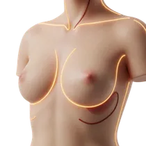 Soft-Tissue Preservation