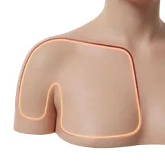 Upper-Pole Hollowness