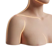 Upper-Pole Cleavage