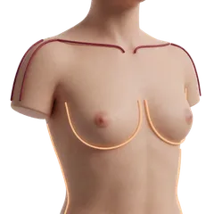 Deep Bra Strap Grooves & Rashes