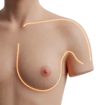 Areola Proportion