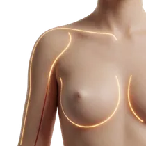 Glandular Weight Relief