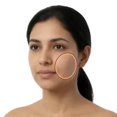 Heavy, Rounded Lower Cheeks