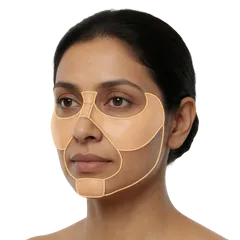 Lack of Submalar Hollow Definition