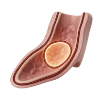 Oral Mucosa Protection
