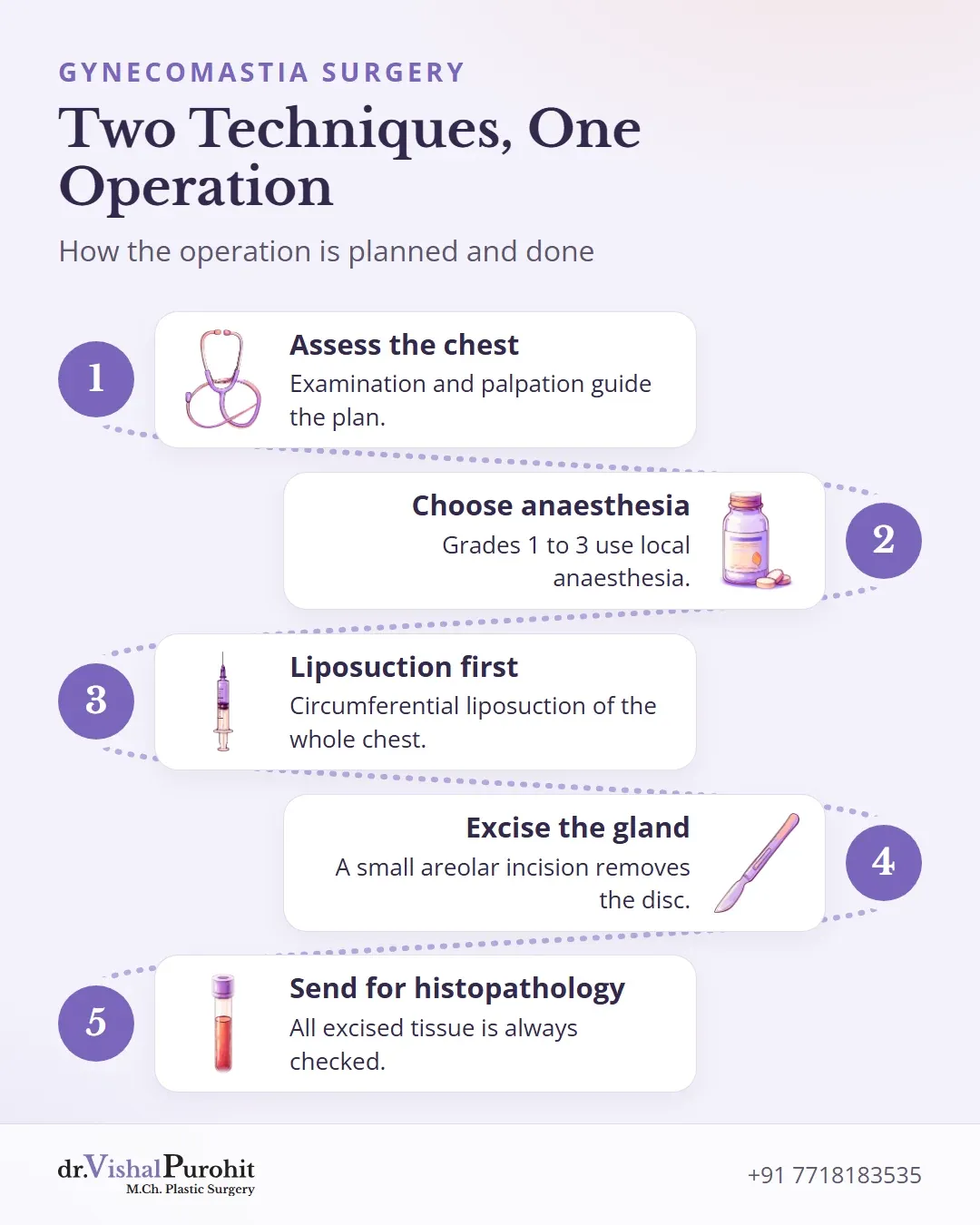 Five steps of the combined liposuction and gland excision operation.