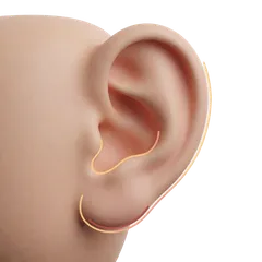 Complete or Partial Earlobe Tear