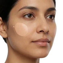 Midface Malar Fat