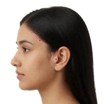 Post-Tragal Hairline