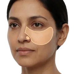 Flat, Undefined Cheeks