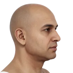 Lack of Mandibular Jaw Angle