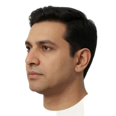 Recessed / Weak Chin Profile