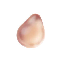 Mandibular Angle Implants