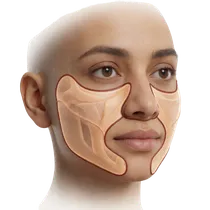 Malar Cheekbone Apex