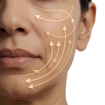 Depressed Facial Scars