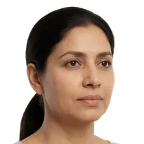 Malar Cheek Apex
