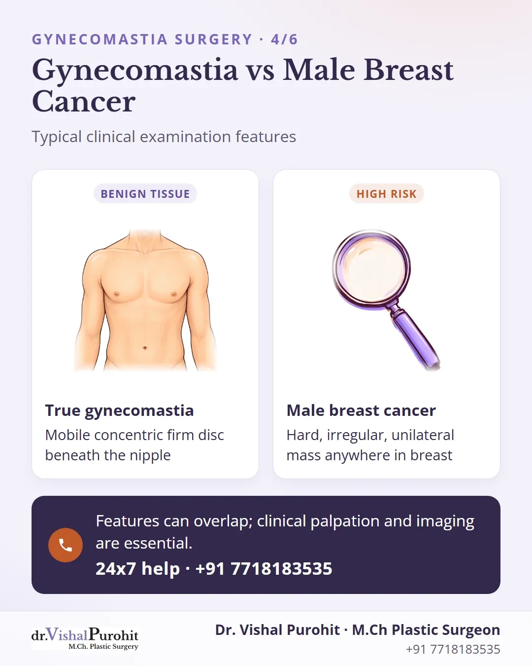Comparison card contrasting examination features of true gynecomastia and male breast cancer