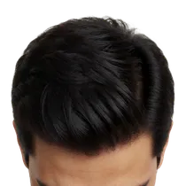 Mid-Scalp Density Zone
