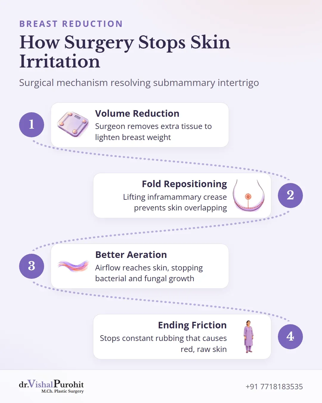 Four steps showing how breast reduction surgery eliminates skin irritation