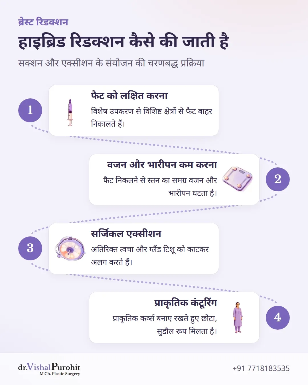 लिपोसक्शन-असिस्टेड ब्रेस्ट रिडक्शन के चार चरणों की प्रक्रिया।
