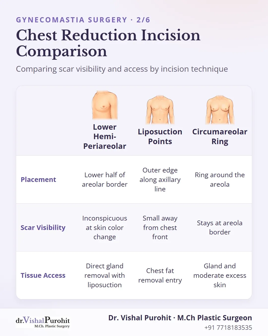 Comparison matrix of lower hemi-periareolar, liposuction entry points, and circumareolar incisions.