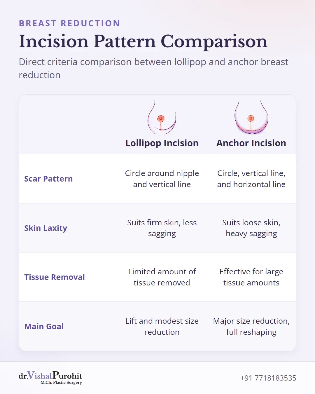 Feature matrix comparing scar pattern, skin laxity, tissue removal, and surgical goals for lollipop versus anchor incisions.