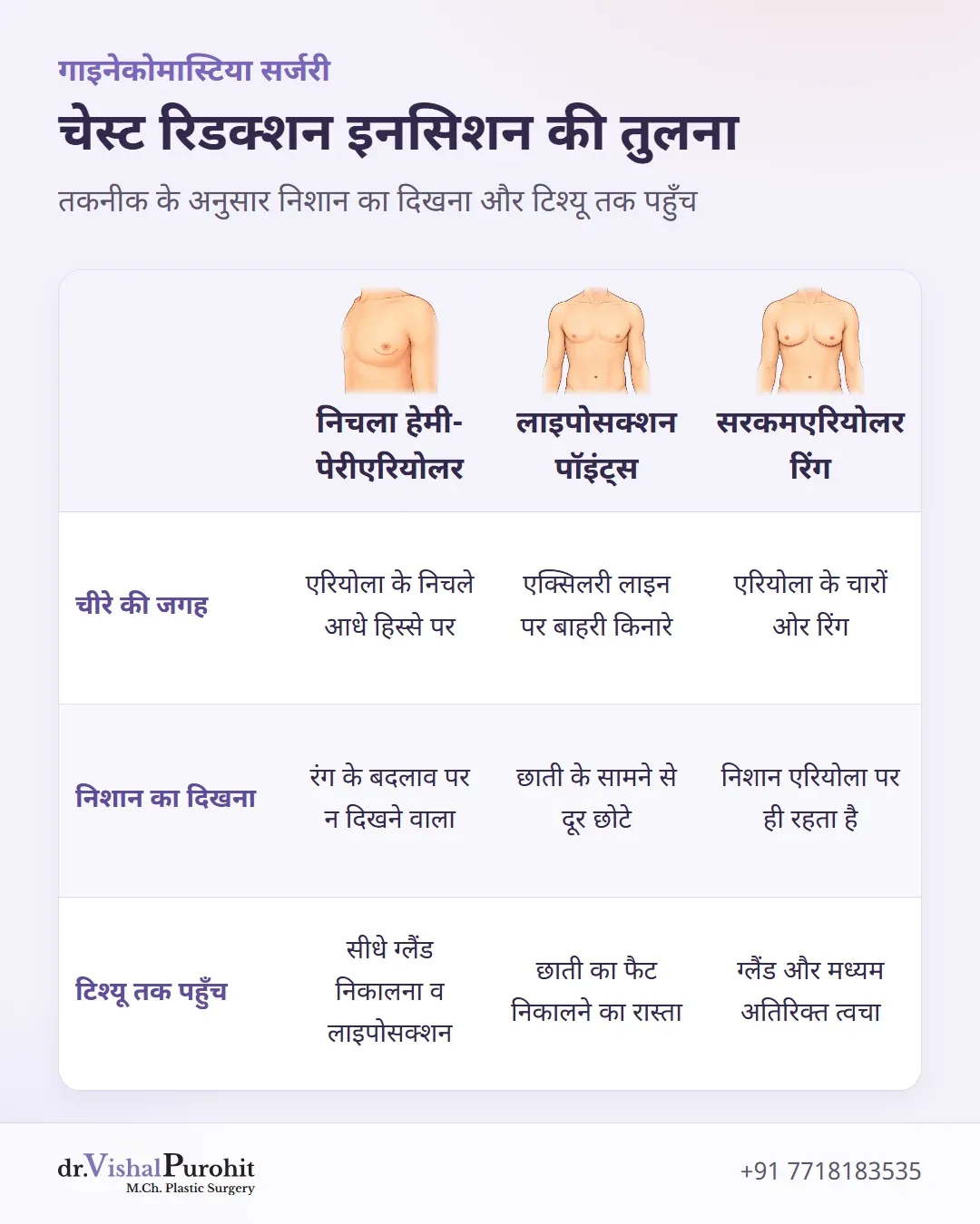 हेमी-पेरीएरियोलर, लाइपोसक्शन पॉइंट्स और सरकमएरियोलर इनसिशन की तुलनात्मक मैट्रिक्स तालिका।