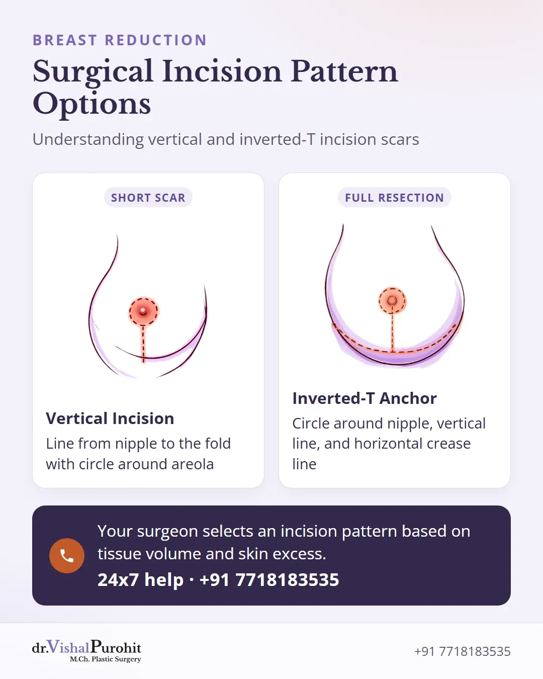 Comparison between vertical and inverted-T anchor incisions for breast reduction.