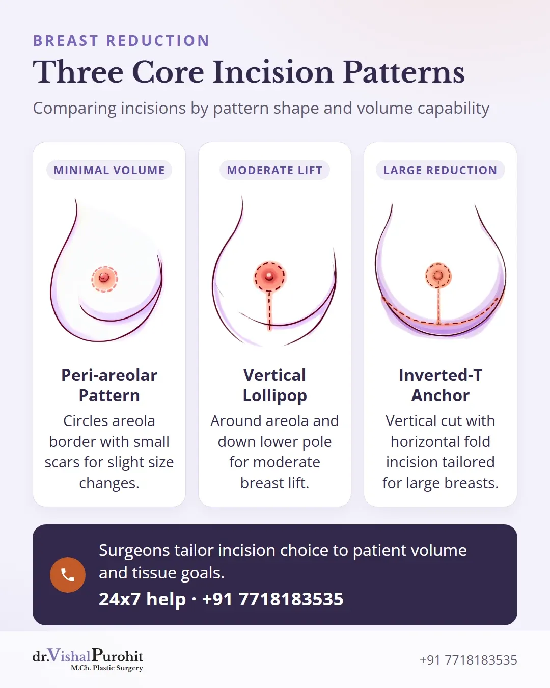 Side-by-side comparison of peri-areolar, vertical lollipop, and inverted-T anchor breast reduction incisions.