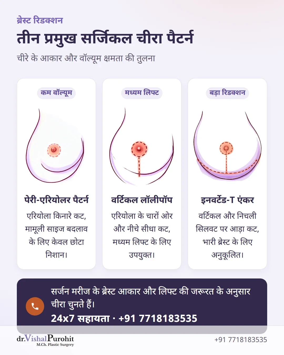पेरी-एरियोलर, वर्टिकल लॉलीपॉप और इनवर्टेड-टी एंकर चीरा पैटर्न की तुलना।