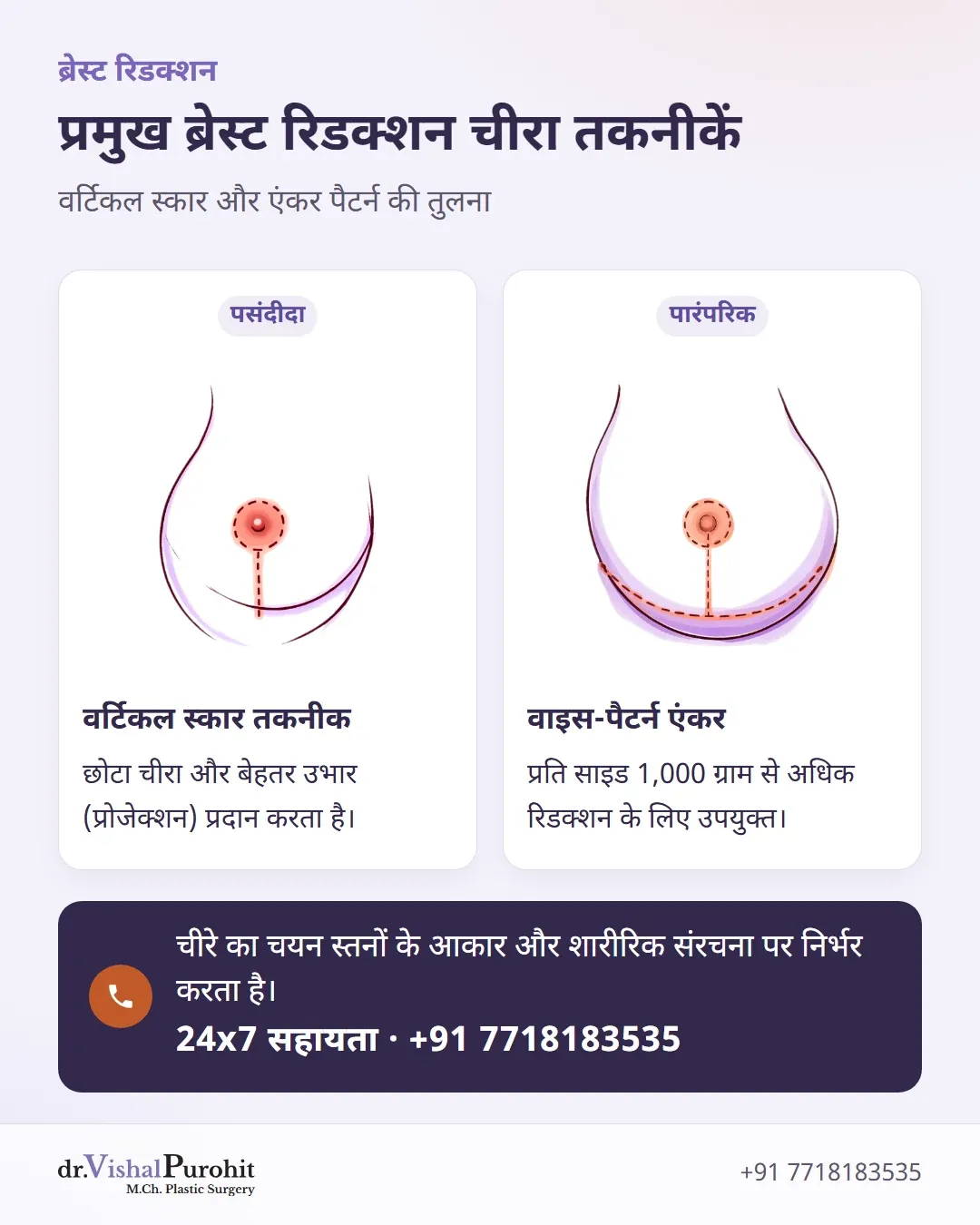 वर्टिकल स्कार और वाइस-पैटर्न एंकर ब्रेस्ट रिडक्शन तकनीकों की तुलना।
