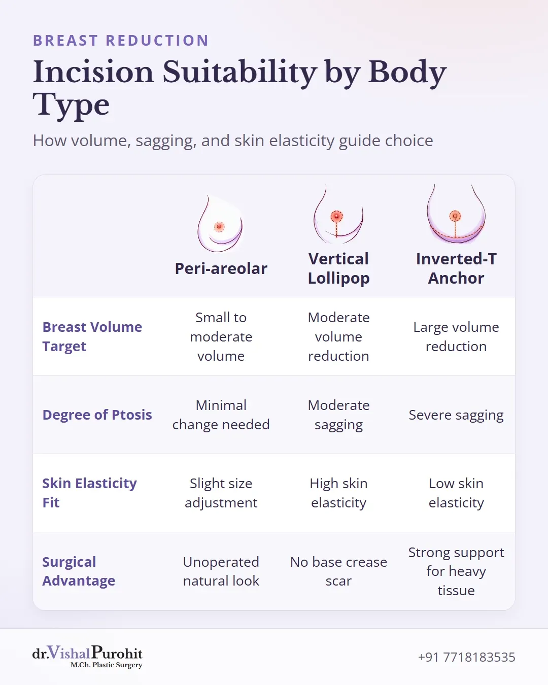 Matrix matching anatomical features like breast volume, ptosis, and skin elasticity to incision techniques.