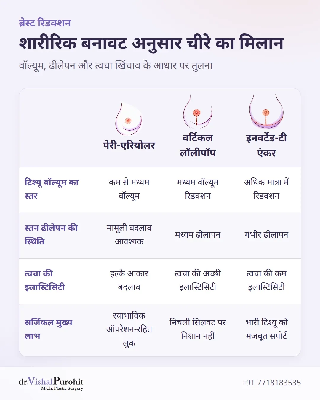 मरीज के शारीरिक लक्षणों जैसे वॉल्यूम, टोसिस और स्किन इलास्टिसिटी के आधार पर चीरे के मिलान की मैट्रिक्स।
