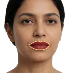 Thin, Undefined Lip Vermilion