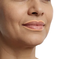 Facial Asymmetry or Irregularity