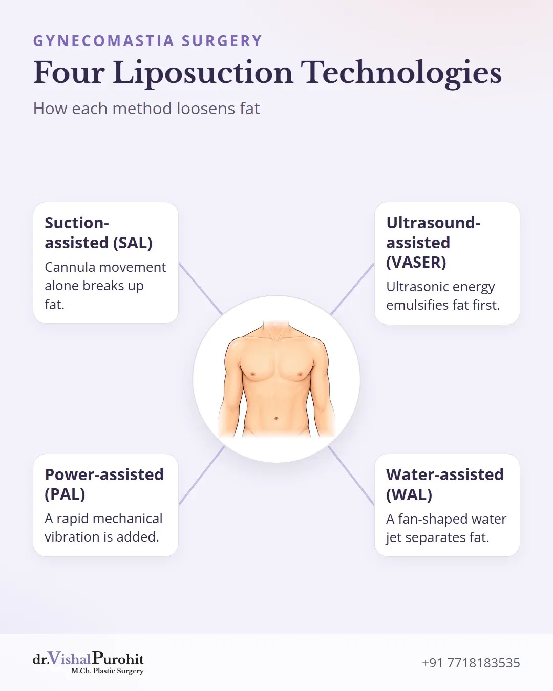 Four liposuction methods and how each loosens fat.