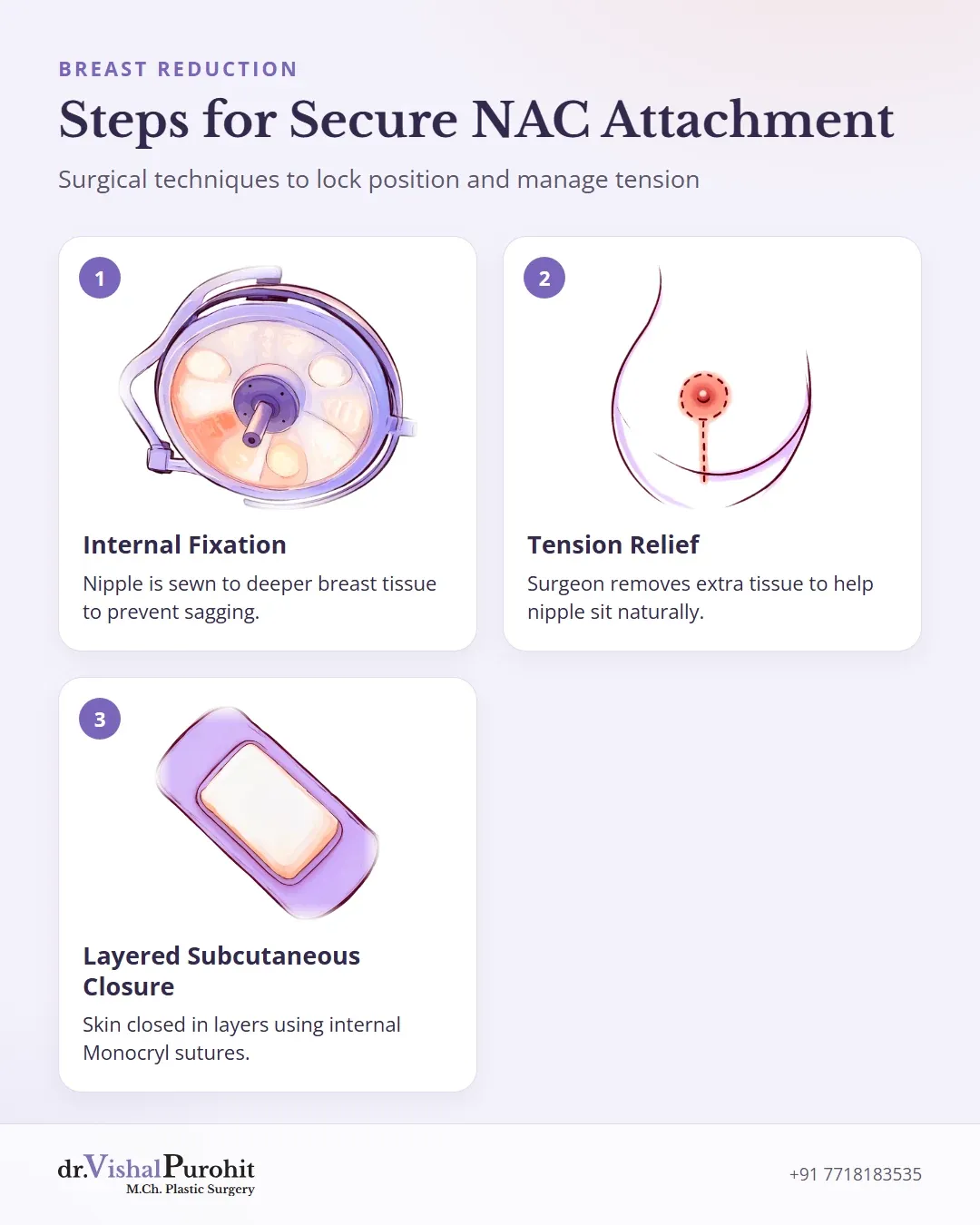 Three key steps for secure nipple-areola complex attachment