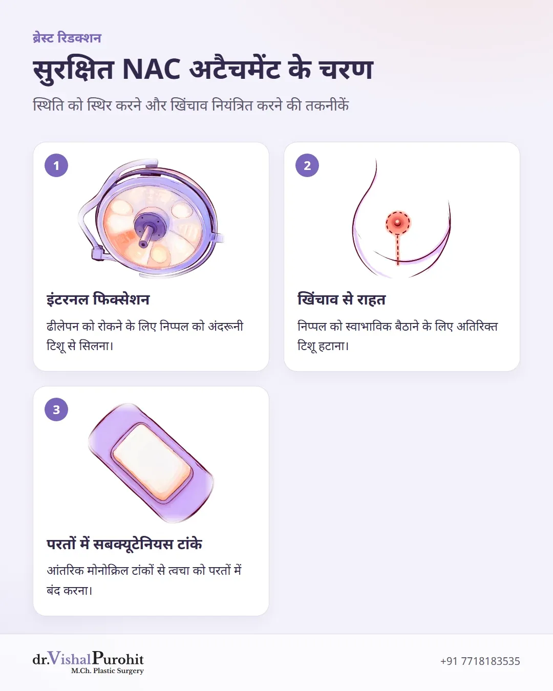 सुरक्षित निप्पल-एरियोला अटैचमेंट के तीन मुख्य सर्जिकल चरण