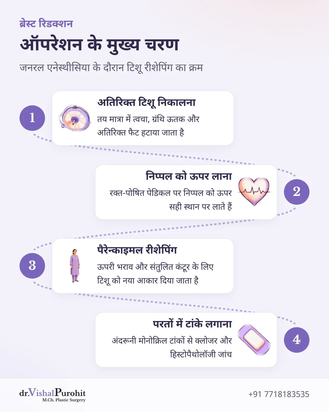 ऑपरेशन के चरण: टिशू निकालना, निप्पल स्थानांतरण, पैरेन्काइमल रीशेपिंग और मोनोक्रिल टांकों से क्लोजर।