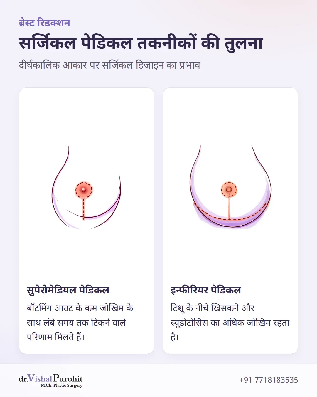 सुपेरोमेडियल और इन्फीरियर सर्जिकल पेडिकल तकनीकों की तुलना