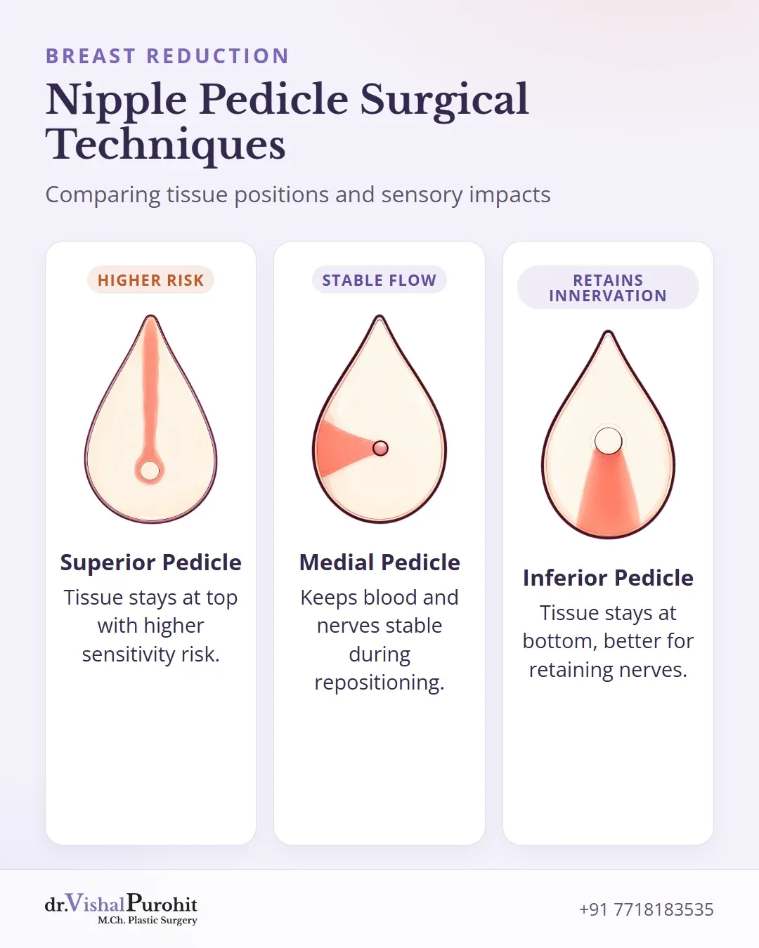 Comparison of superior, medial, and inferior nipple pedicle surgical techniques