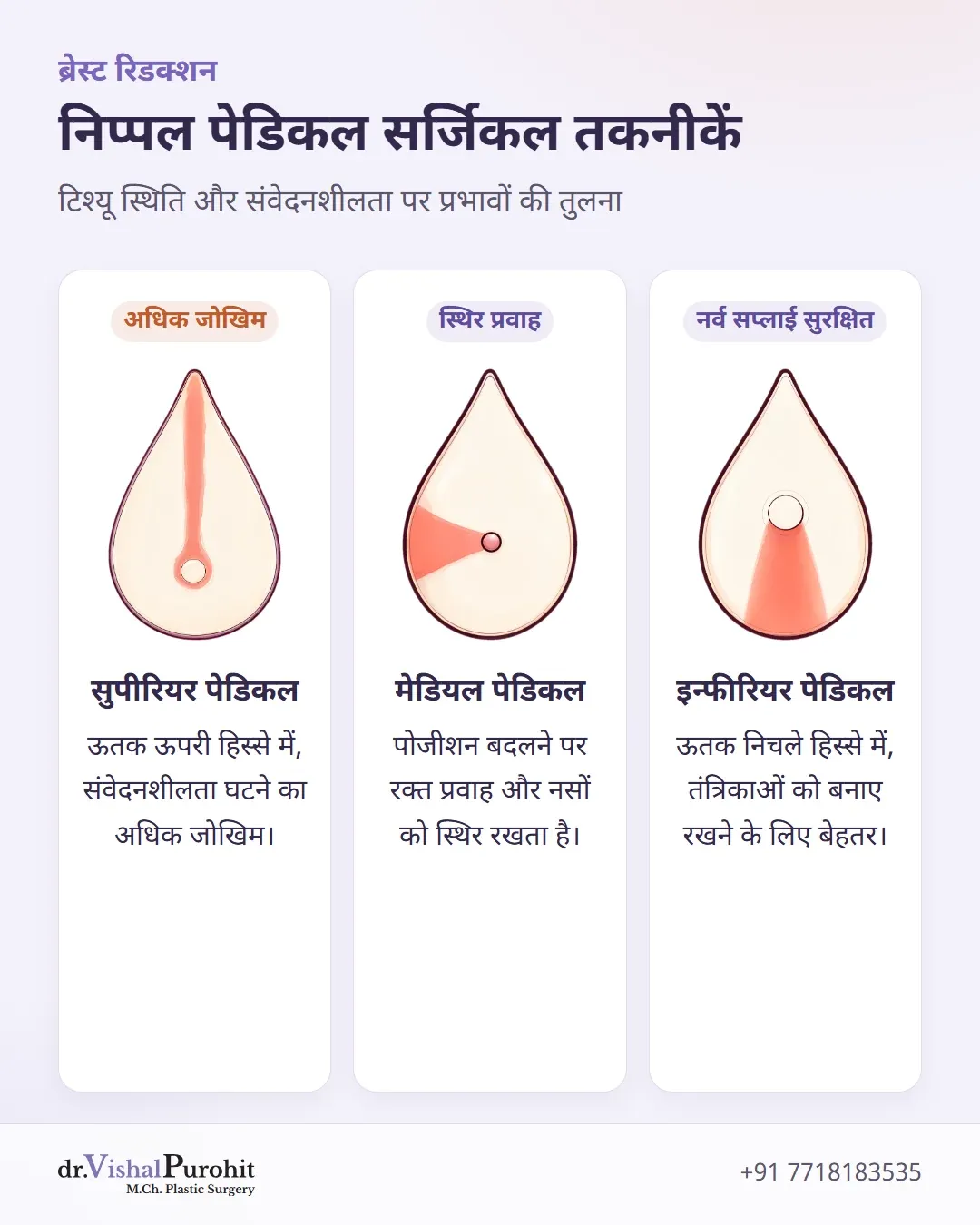 सुपीरियर, मेडियल और इन्फीरियर निप्पल पेडिकल तकनीकों की तुलना