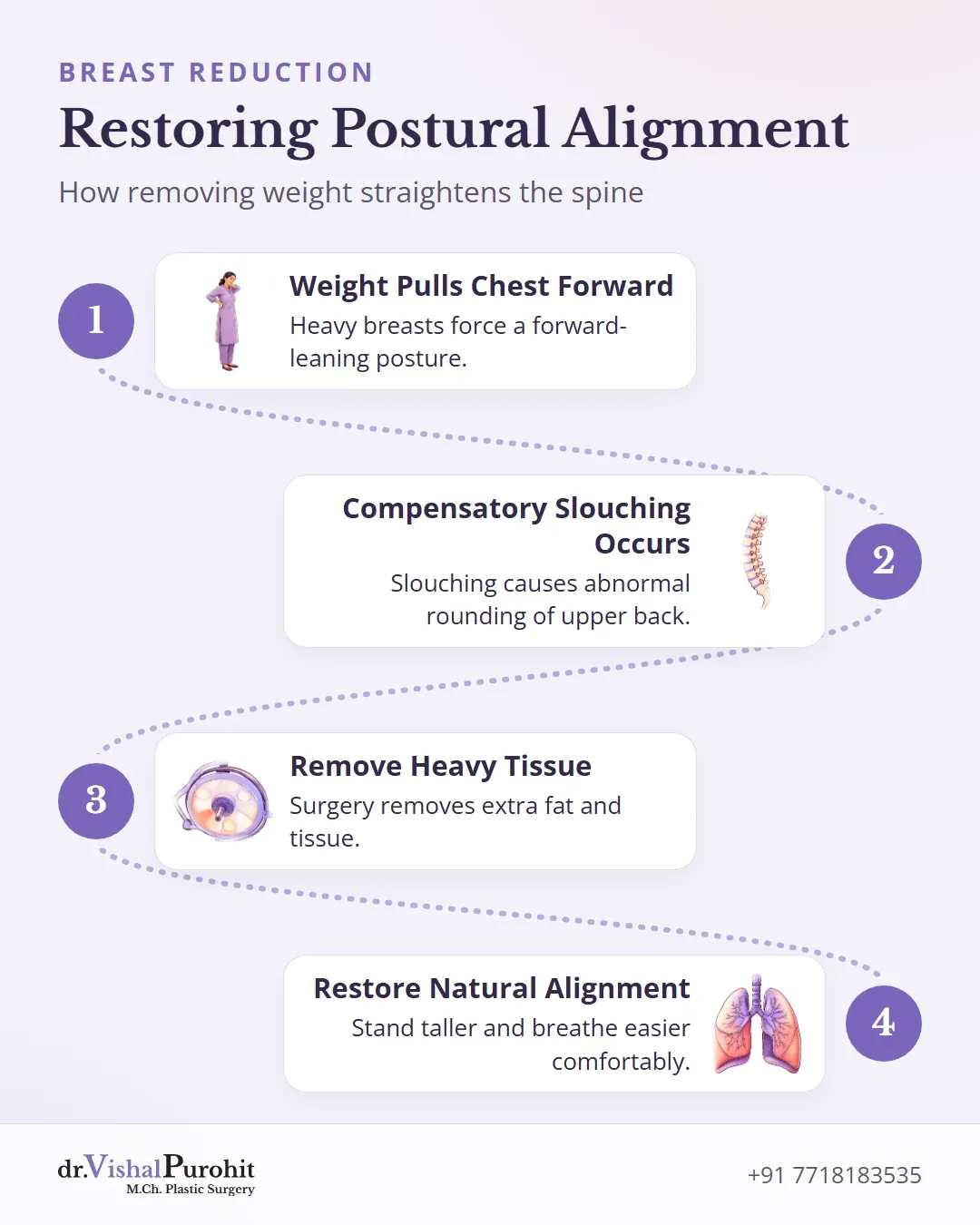 Steps showing how breast reduction reverses slouching and restores upright posture.