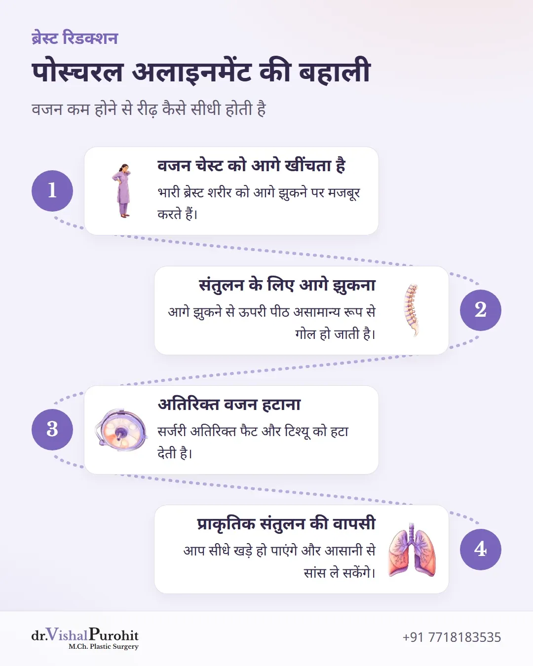 प्रक्रिया जो दर्शाती है कि ब्रेस्ट रिडक्शन कैसे झुके पोस्चर को ठीक कर रीढ़ को सीधा करता है।