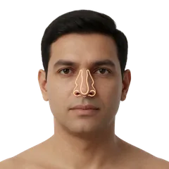 Deviated Septum & Breathing Obstruction
